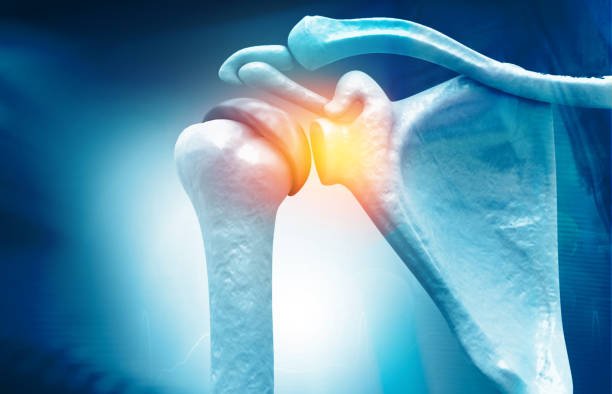 Arthroscopic Cuff Repair