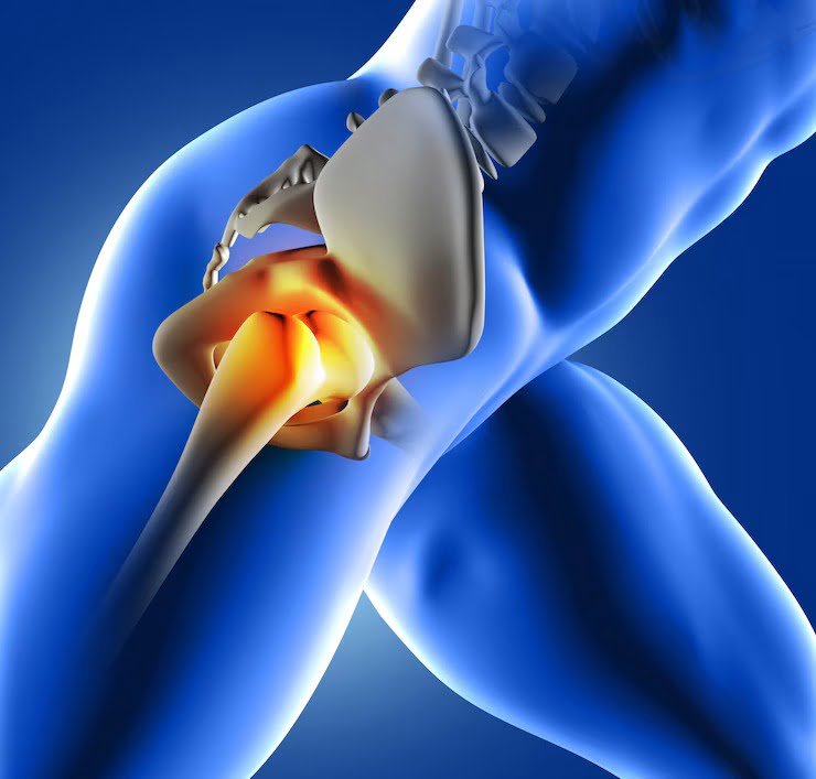 Hip Arthroscopy Treatment in Ghaziabad