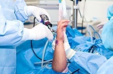 Wrist Arthroscopy Surgery in Indirapuram