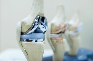 Best Robotic Knee Replacement Specialist in Indirapuram