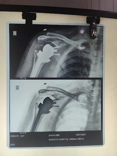 Best Orthopedic Surgery Hospital in Noida