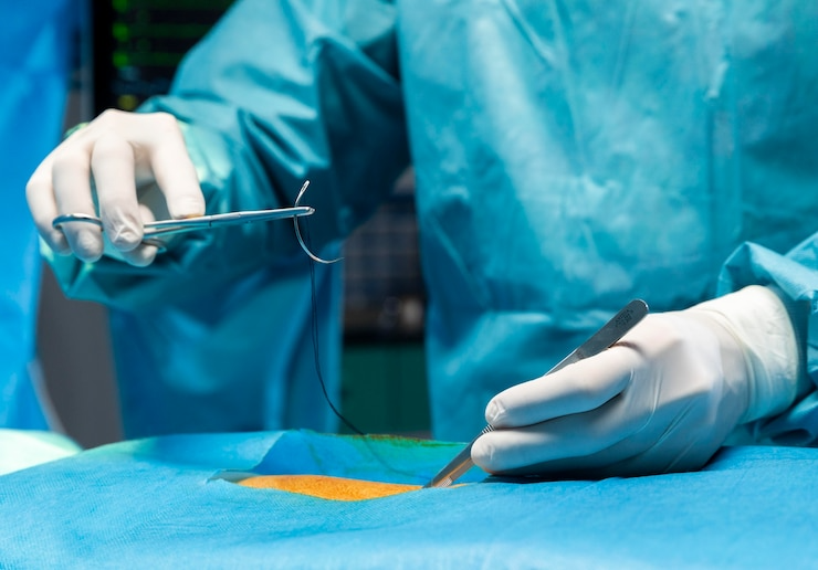 Best arthroscopic bankart repair surgery in Ghaziabad