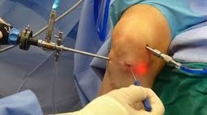 Best Arthroscopy in Sector 20