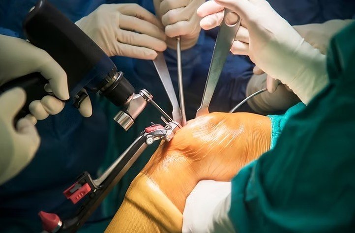 Best Joint Replacement Surgeon in Noida