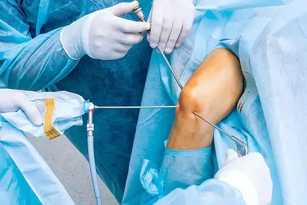 Best Arthroscopy Doctor in Ghaziabad
